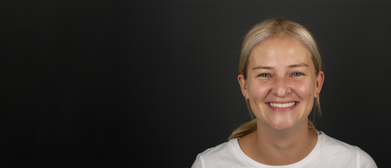 Patricija Digital Smile Academy Klinički slučajevi