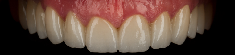 Bosteeth_0001_Layer 1