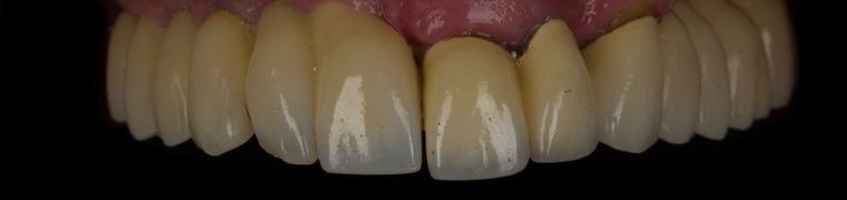 zubi_0000_Generative Fill copy