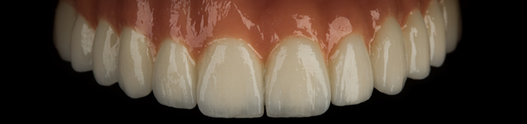 zubi_0001_Generative Fill